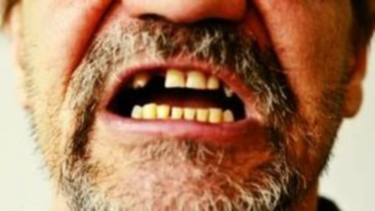 Сопутствующие заболевания при лечении зубов